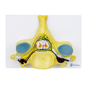 5ª Vertebra Cervical ampliada 7 vezes CL78