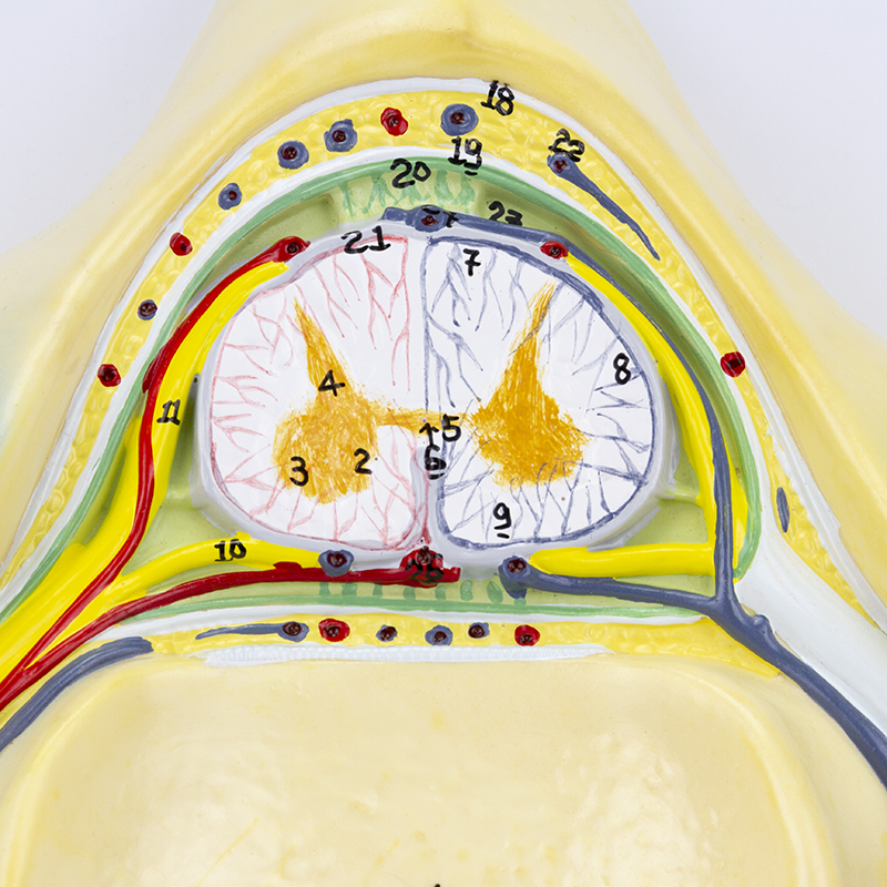 5ª Vertebra Cervical ampliada 7 vezes CL78