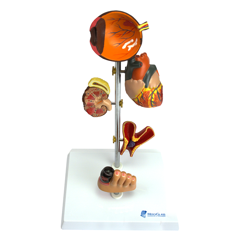 Efeitos da Diabetes 5 partes DI10