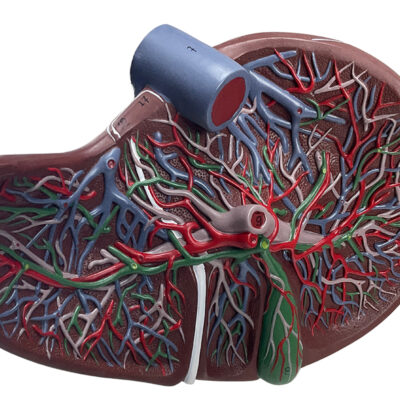 Seção do Fígado com Vesícula Biliar FI26