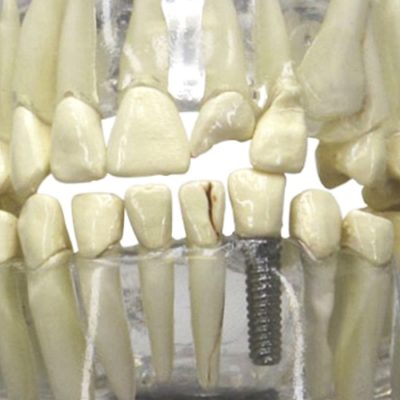 Mandíbula Humana Translúcida com Dentes - detalhe