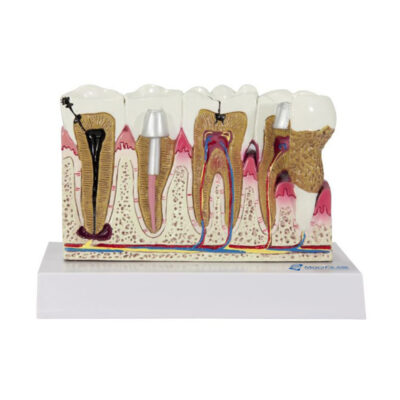 Modelo de Dentes com Gengiva DE08