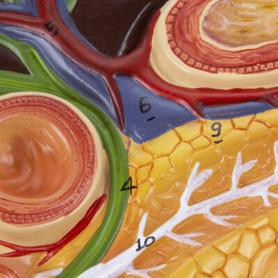 Fígado com Vesícula Biliar Pâncreas e Duodeno FI315
