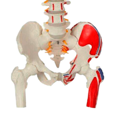 Coluna de Luxo Flexível com Cabeca de Femur CL587