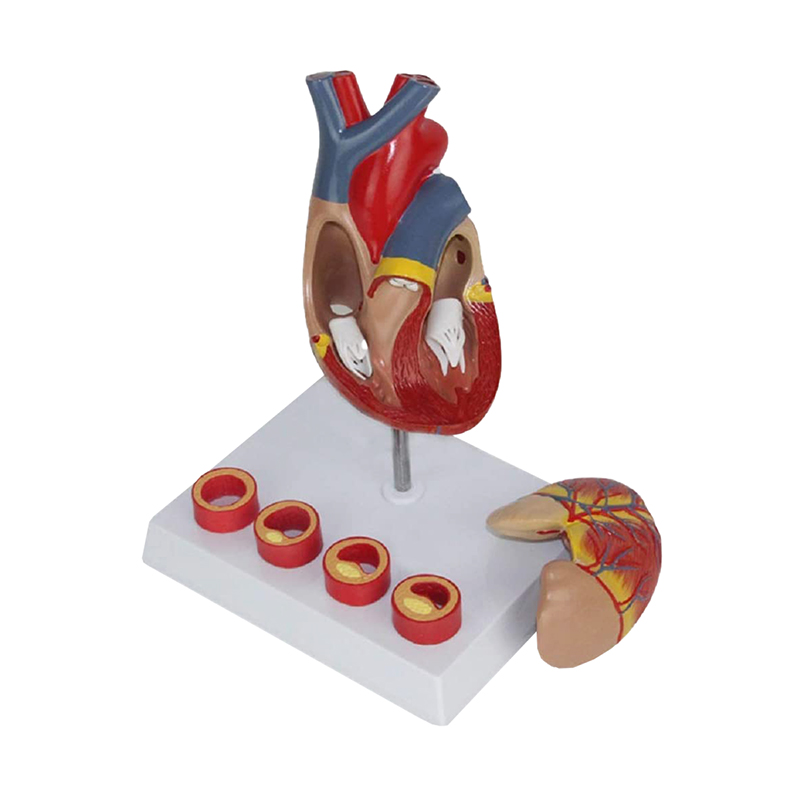 Coração com Demonstração de Arteriosclerose CO06