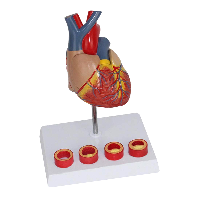 Coração com Demonstração de Arteriosclerose CO06