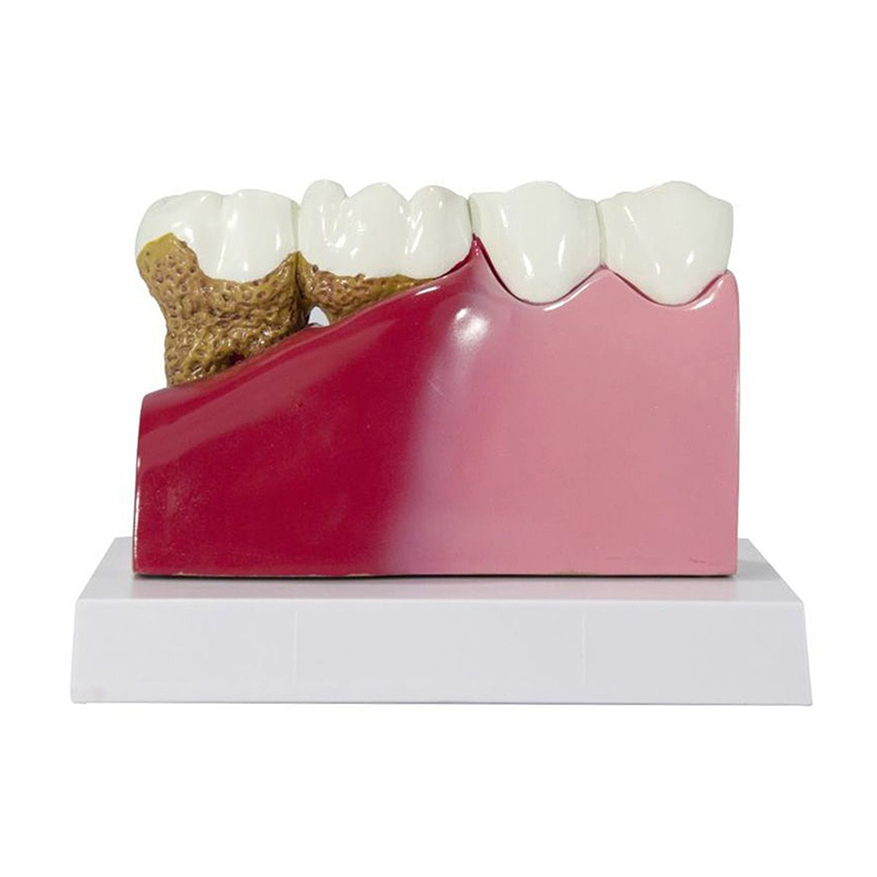 Modelo de Dentes com Gengiva DE08 