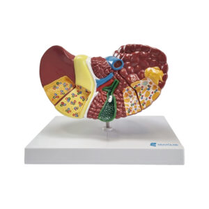 Seção de Luxo do Fígado com patologia FI11 