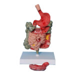 Trato Intestinal com Patologias SD50