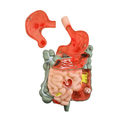 Trato Intestinal com Patologias SD50