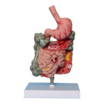 Trato Intestinal com Patologias SD50